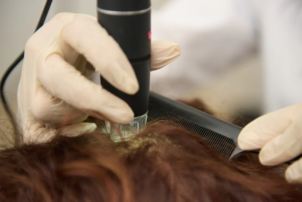 Consulenza analisi del capello